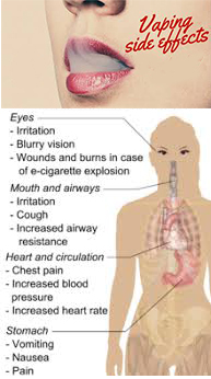 Adverse Effects of Vaping